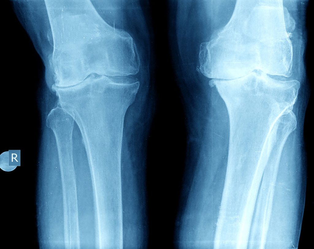 x-rays-vs-mris-do-i-really-need-x-rays-dr-david-geier-sports