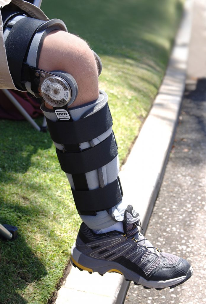 Do you need a knee brace for a torn MCL? Dr Geier