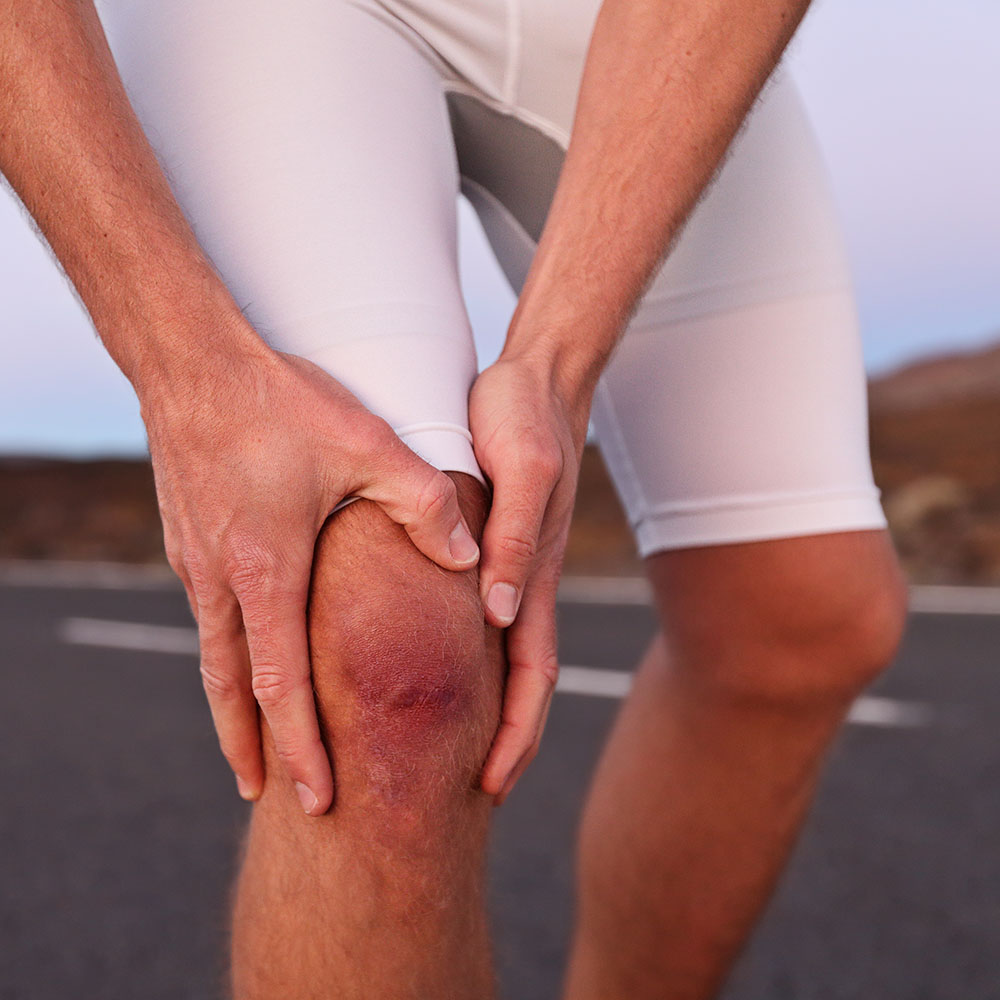 Упала сильно на колени. Спортивная травма колена. Спортивные травмы коленного сустава.