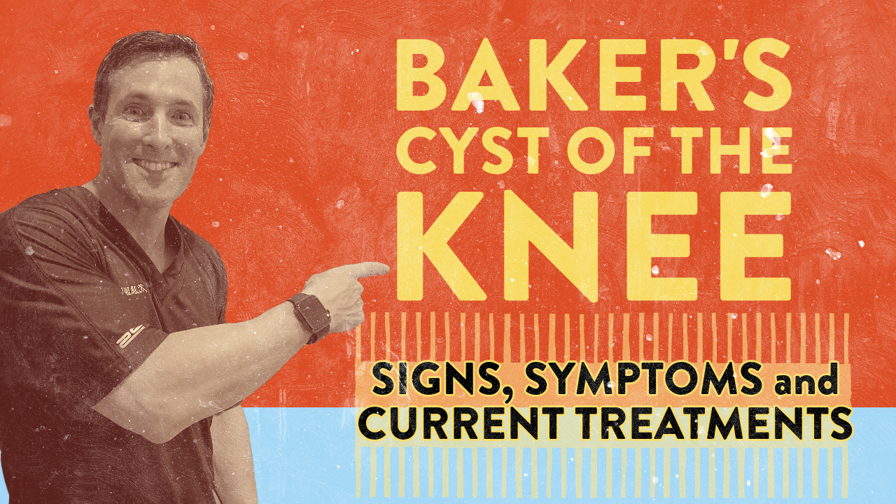 Bakers Cyst Of The Knee Signs Symptoms And Current Treatments Dr Geier 3994