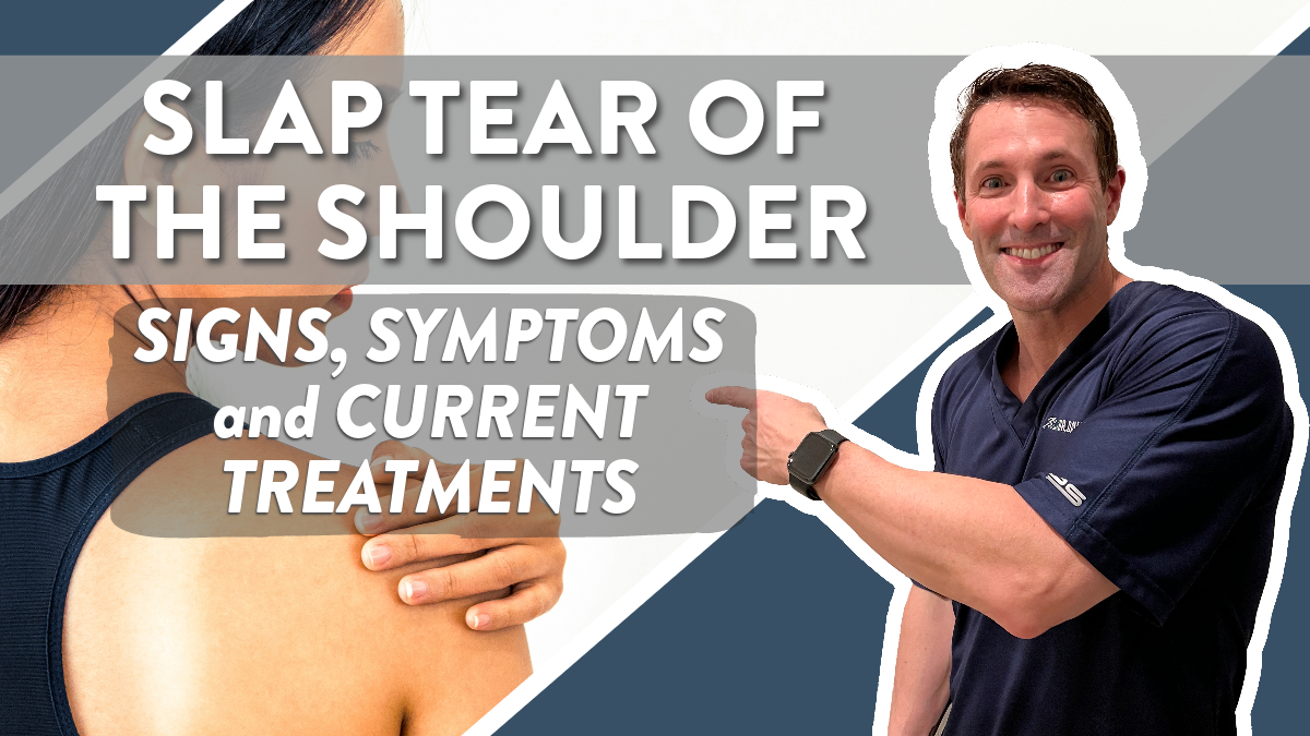 SLAP tear of the shoulder: Signs, symptoms and current treatments | Dr ...