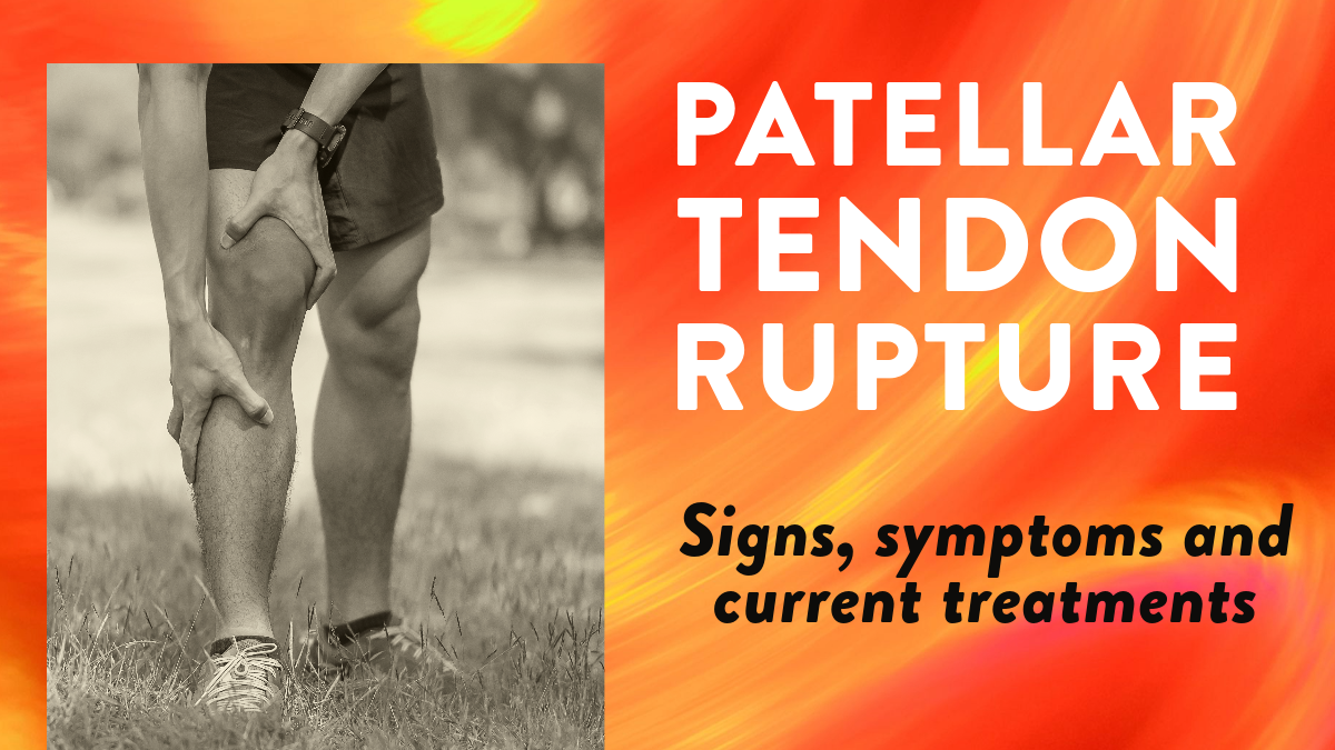 Patellar tendon rupture: Signs, symptoms and current treatments | Dr Geier